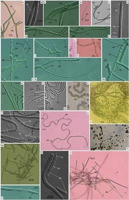 Polyphasic evaluation and cytotoxic investigation of isolated cyanobacteria with an emphasis on potent activities of a Scytonema strain